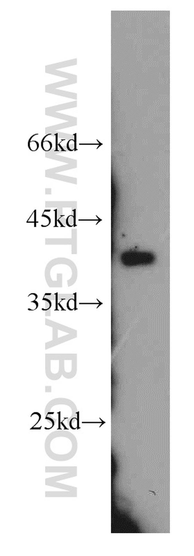 APOL1 Antibody in Western Blot (WB)