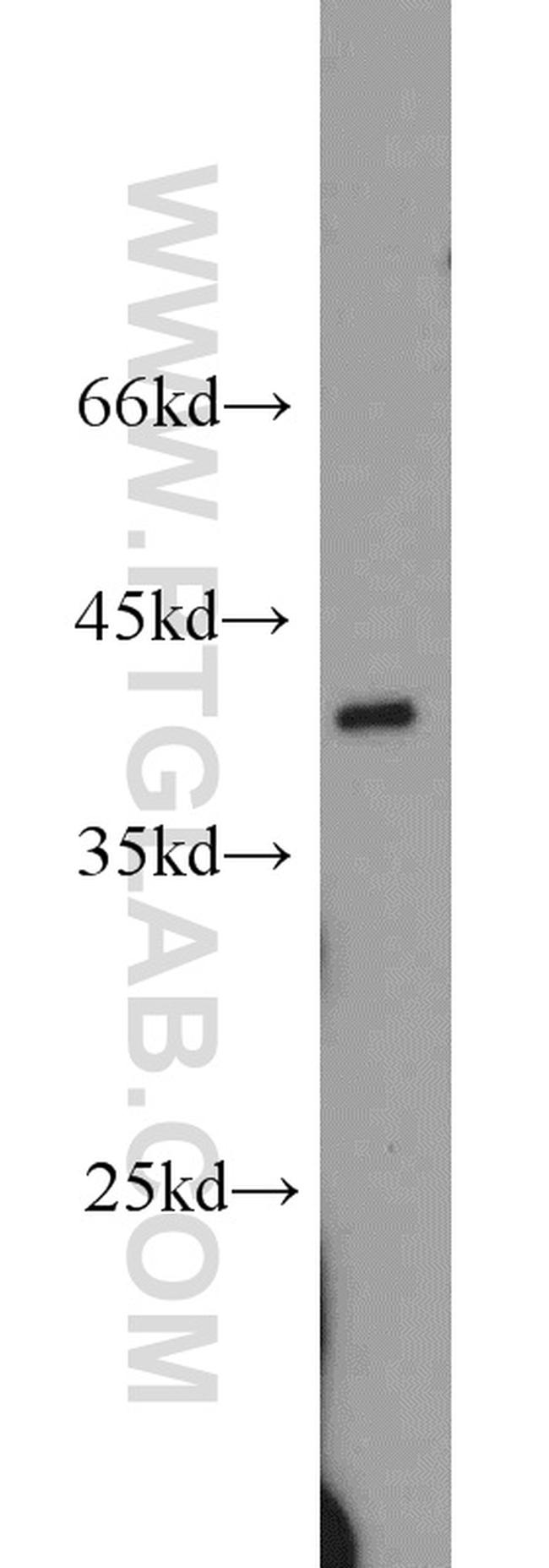 APOL1 Antibody in Western Blot (WB)