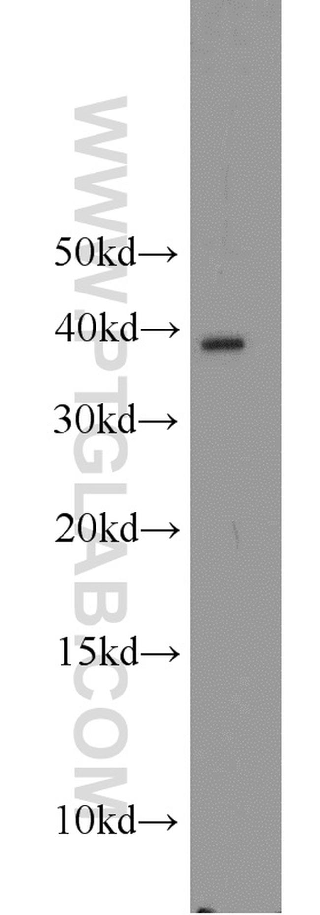 APOL1 Antibody in Western Blot (WB)