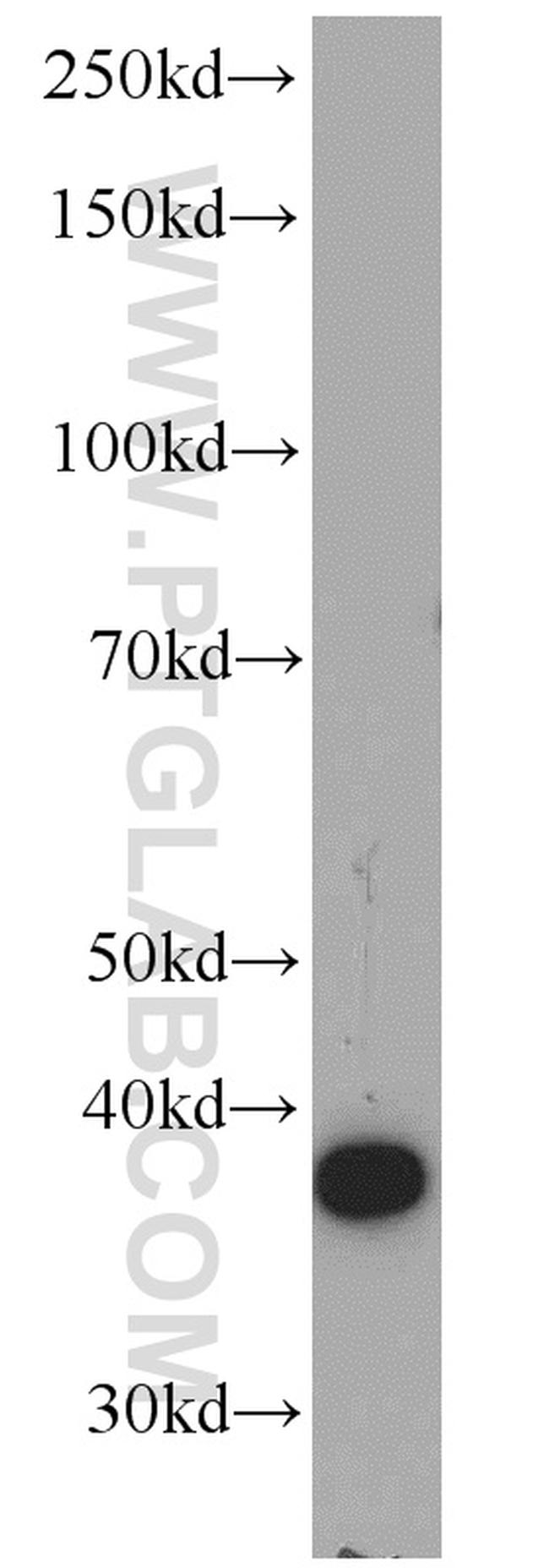 APOL1 Antibody in Western Blot (WB)