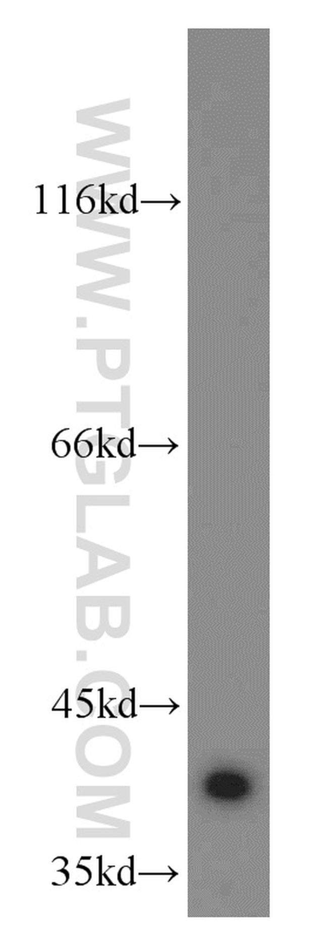 APOL1 Antibody in Western Blot (WB)