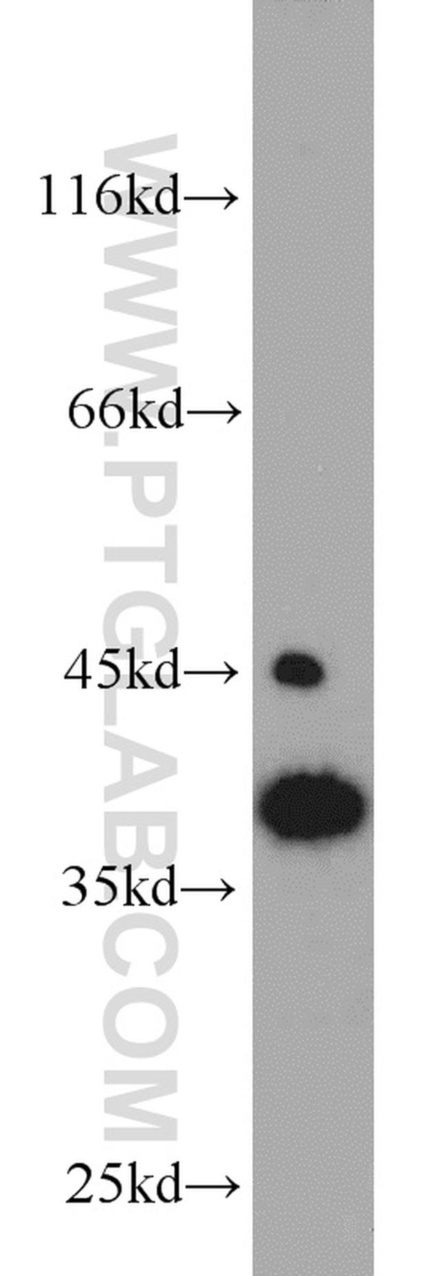 APOL1 Antibody in Western Blot (WB)