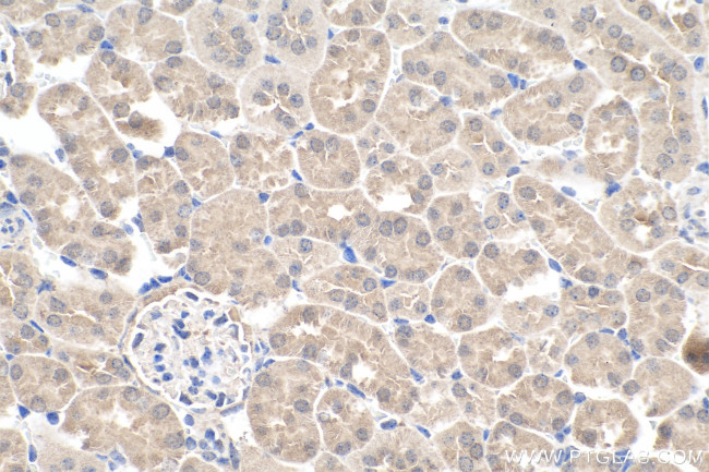 APOL1 Antibody in Immunohistochemistry (Paraffin) (IHC (P))