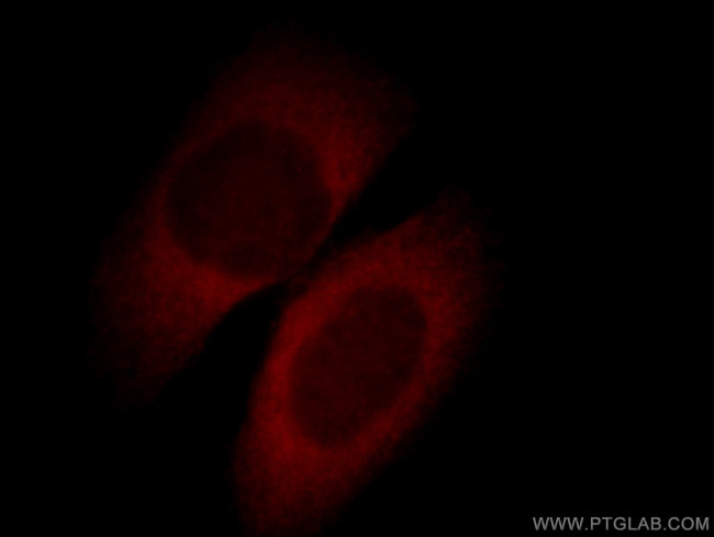 APOL1 Antibody in Immunocytochemistry (ICC/IF)