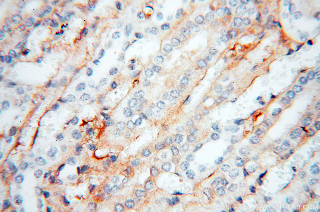 APOL1 Antibody in Immunohistochemistry (Paraffin) (IHC (P))