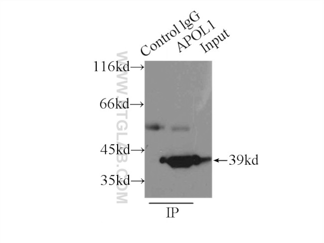 APOL1 Antibody in Immunoprecipitation (IP)