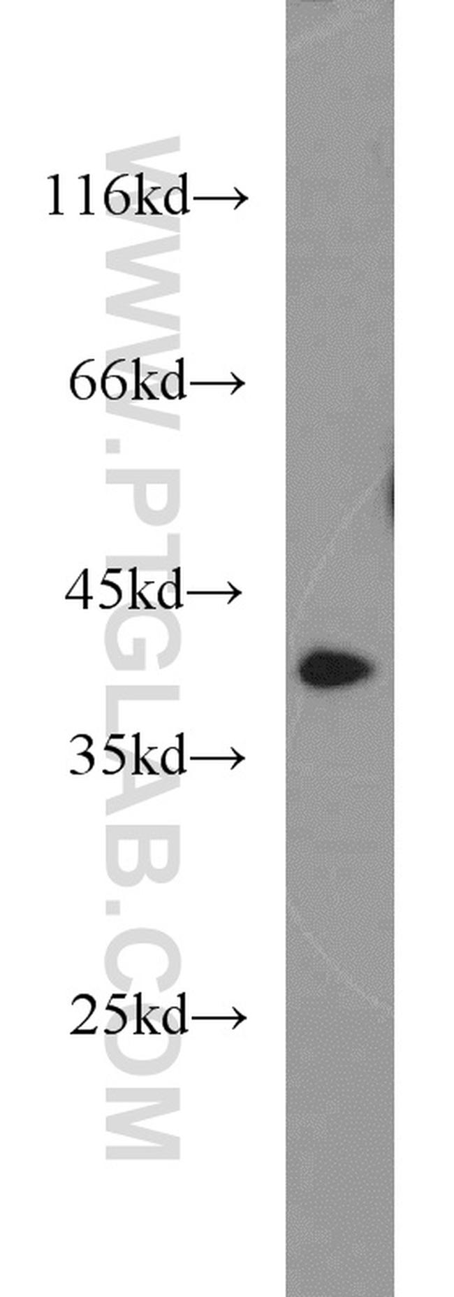 APOL1 Antibody in Western Blot (WB)