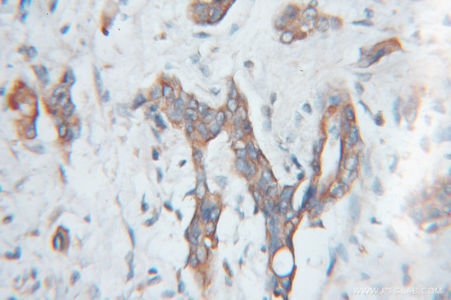 SCMH1 Antibody in Immunohistochemistry (Paraffin) (IHC (P))