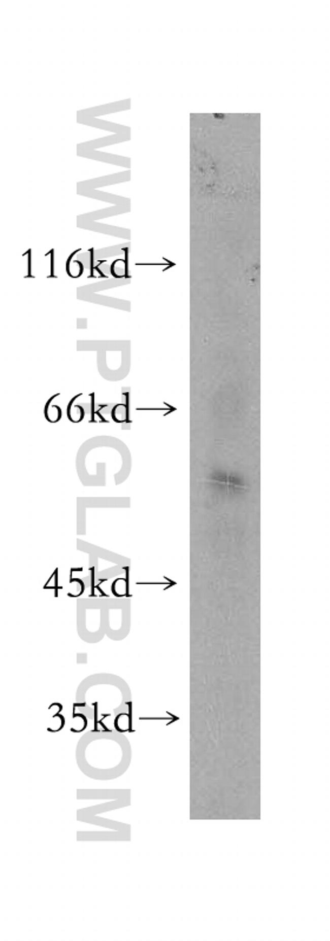 SCMH1 Antibody in Western Blot (WB)