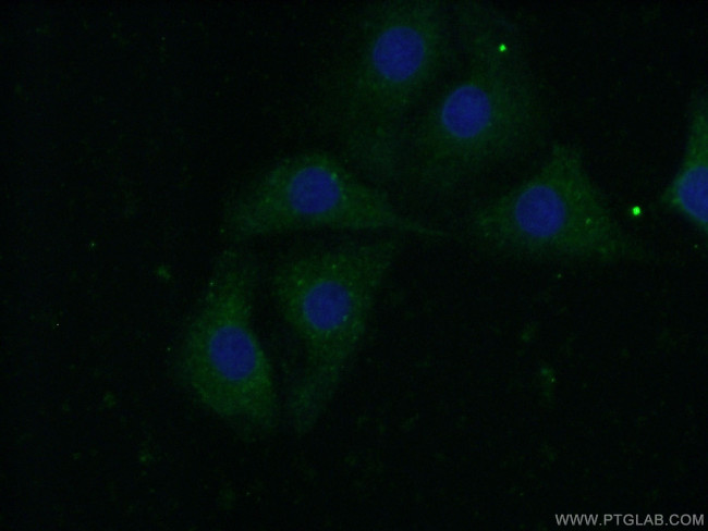 CAPS1 Antibody in Immunocytochemistry (ICC/IF)