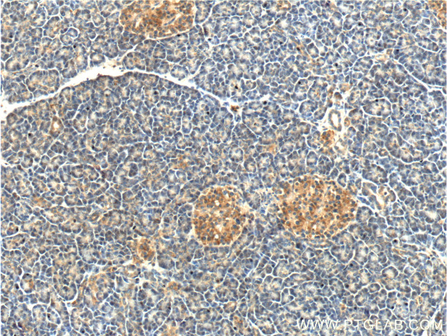 CAPS1 Antibody in Immunohistochemistry (Paraffin) (IHC (P))