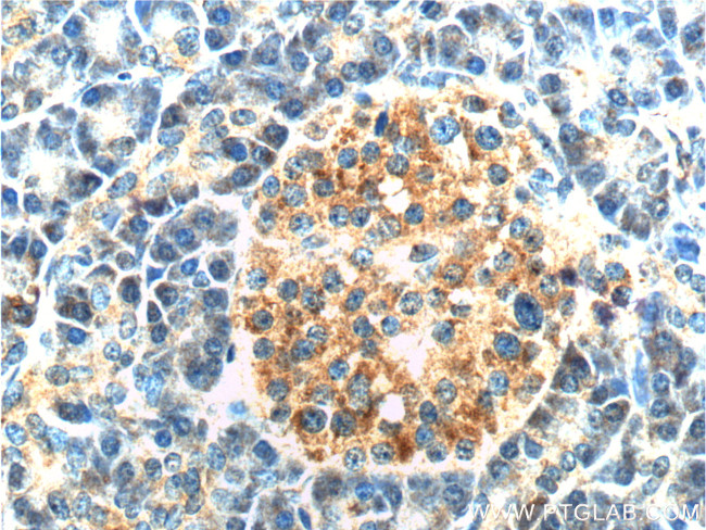 CAPS1 Antibody in Immunohistochemistry (Paraffin) (IHC (P))