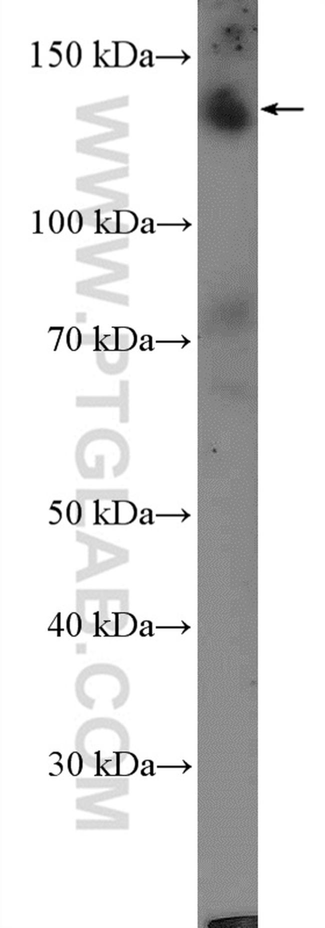 CAPS1 Antibody in Western Blot (WB)