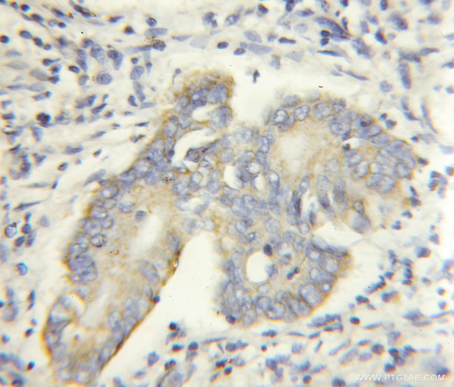 PHACS Antibody in Immunohistochemistry (Paraffin) (IHC (P))