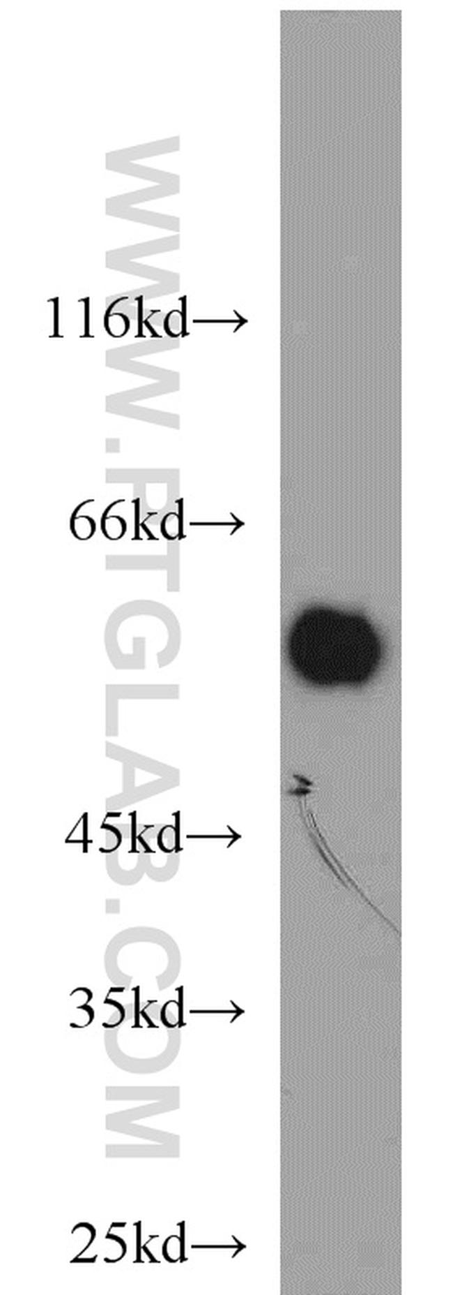 PHACS Antibody in Western Blot (WB)