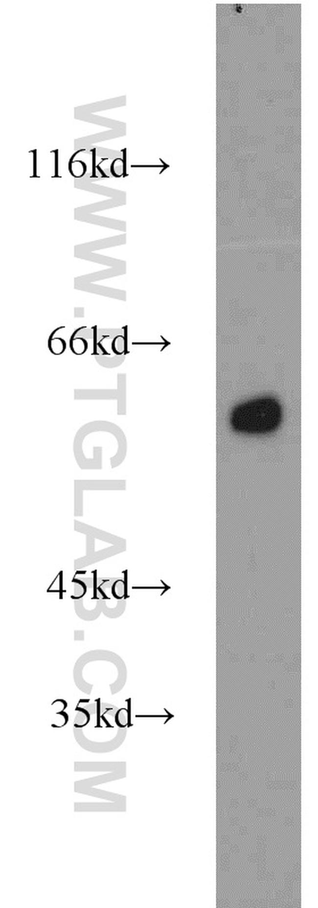 PHACS Antibody in Western Blot (WB)