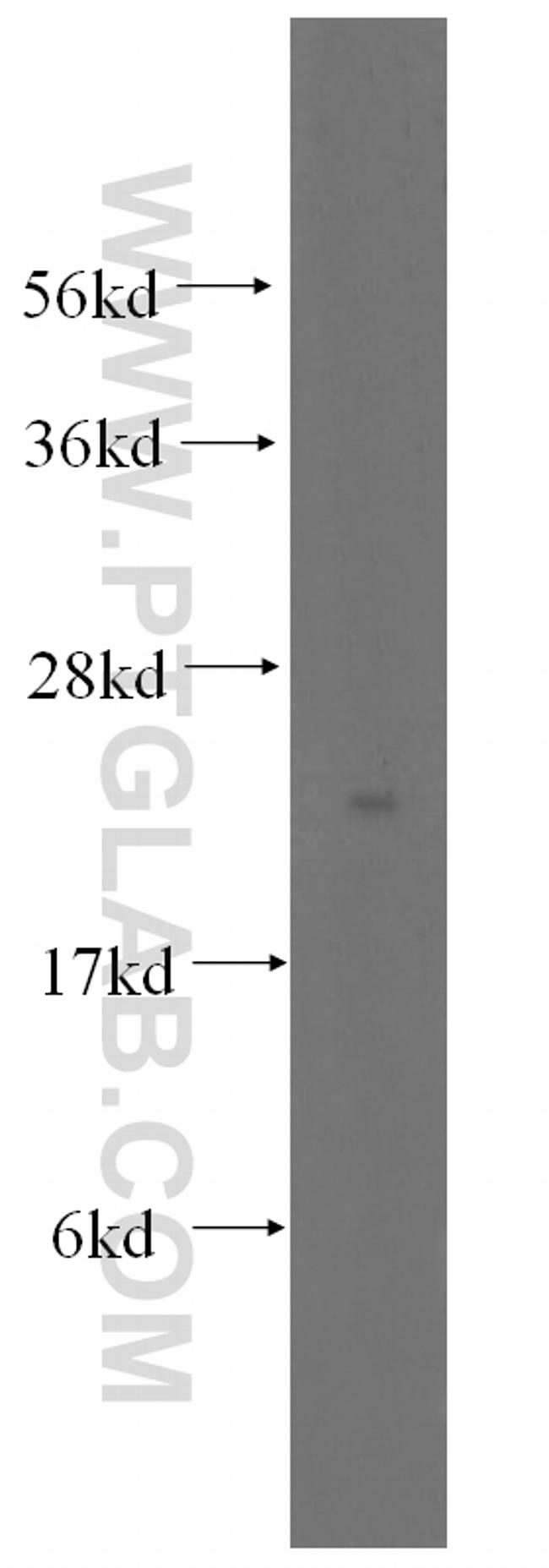 PTPMT1 Antibody in Western Blot (WB)