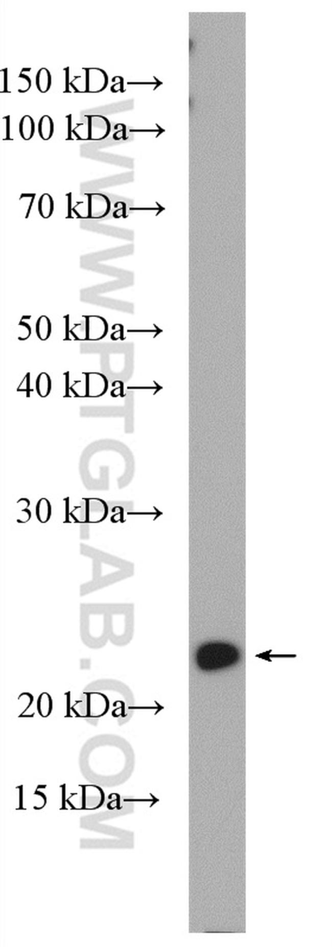 PTPMT1 Antibody in Western Blot (WB)