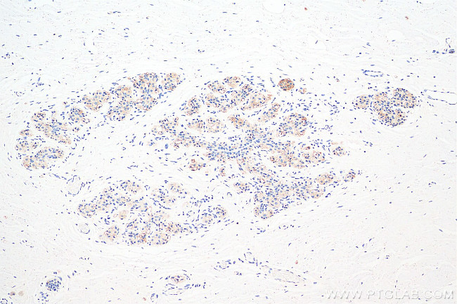 Apelin Antibody in Immunohistochemistry (Paraffin) (IHC (P))