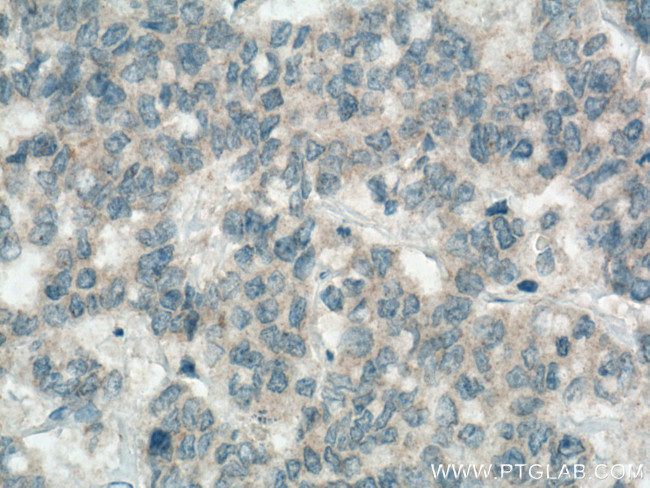 Apelin Antibody in Immunohistochemistry (Paraffin) (IHC (P))