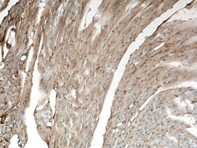 Apelin Antibody in Immunohistochemistry (Paraffin) (IHC (P))