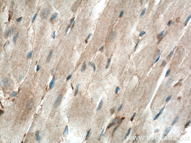 Apelin Antibody in Immunohistochemistry (Paraffin) (IHC (P))