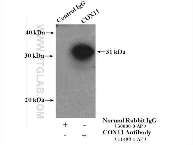 COX11 Antibody in Immunoprecipitation (IP)