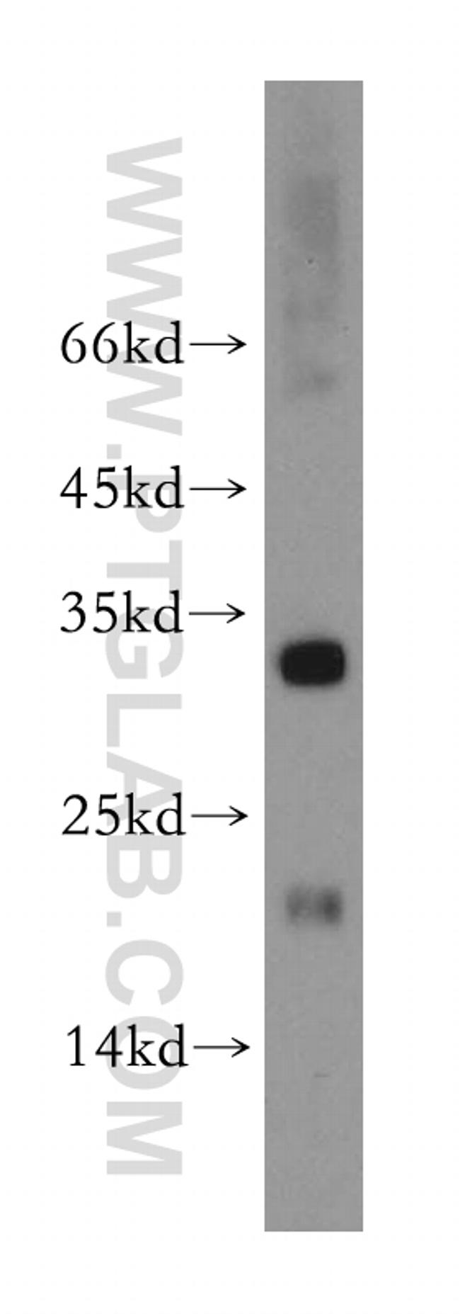 COX11 Antibody in Western Blot (WB)