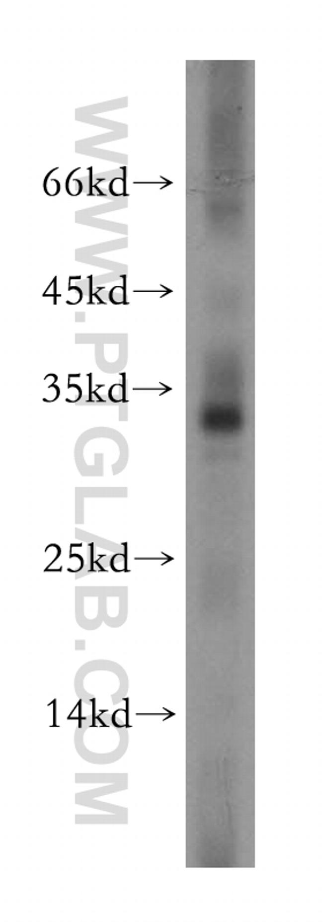 COX11 Antibody in Western Blot (WB)