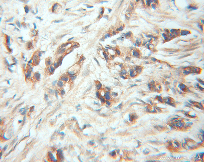 FRS2 Antibody in Immunohistochemistry (Paraffin) (IHC (P))