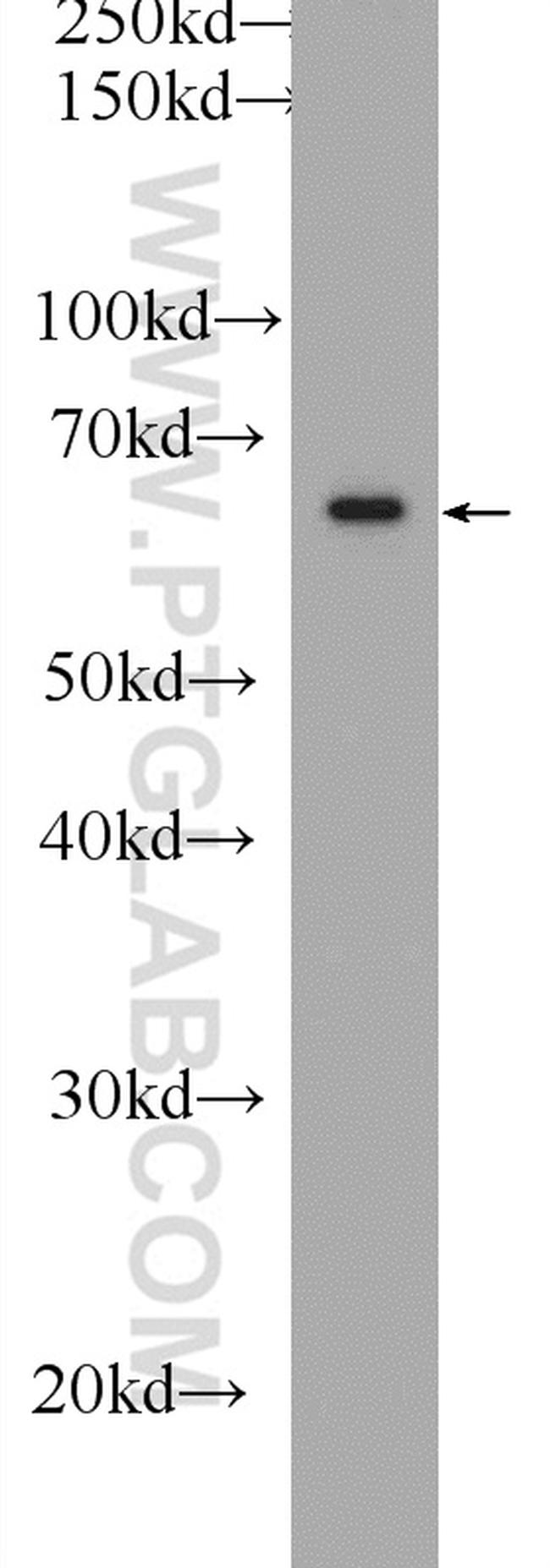 FRS2 Antibody in Western Blot (WB)