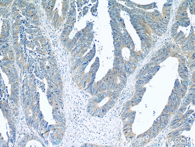 BubR1 Antibody in Immunohistochemistry (Paraffin) (IHC (P))