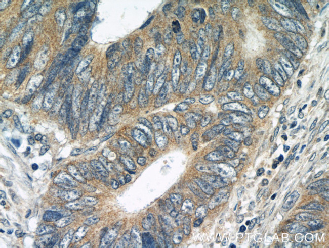 BubR1 Antibody in Immunohistochemistry (Paraffin) (IHC (P))