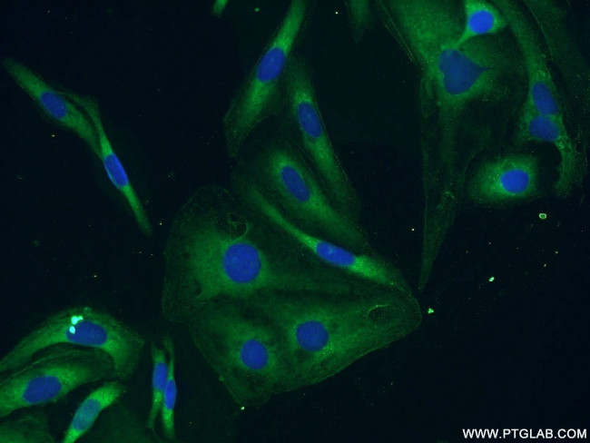 BubR1 Antibody in Immunocytochemistry (ICC/IF)