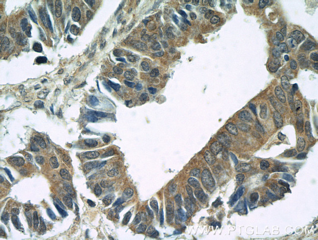 BubR1 Antibody in Immunohistochemistry (Paraffin) (IHC (P))