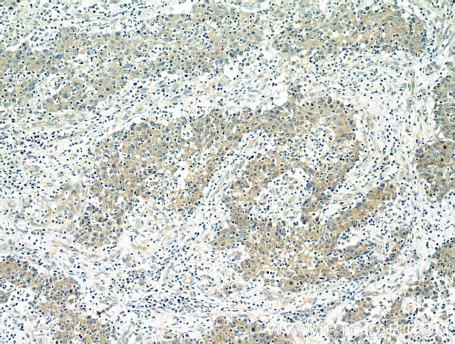 BubR1 Antibody in Immunohistochemistry (Paraffin) (IHC (P))