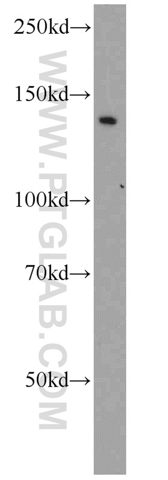 BubR1 Antibody in Western Blot (WB)