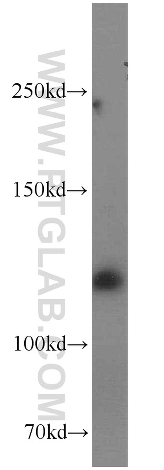 BubR1 Antibody in Western Blot (WB)