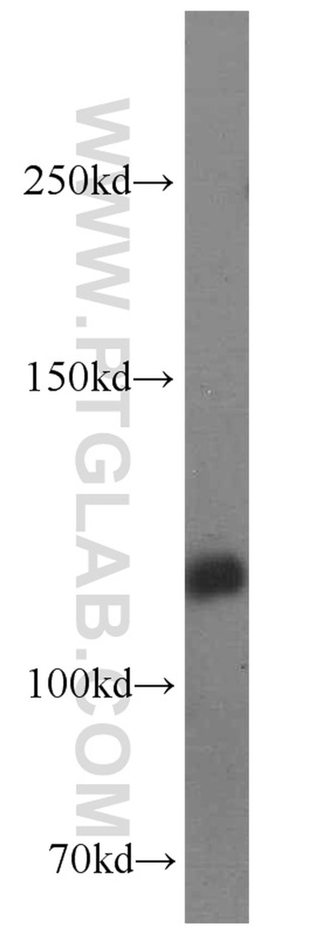 BubR1 Antibody in Western Blot (WB)