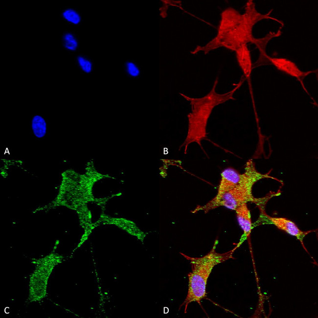 Cav3.2 Ca+2 Channel Antibody in Immunocytochemistry (ICC/IF)