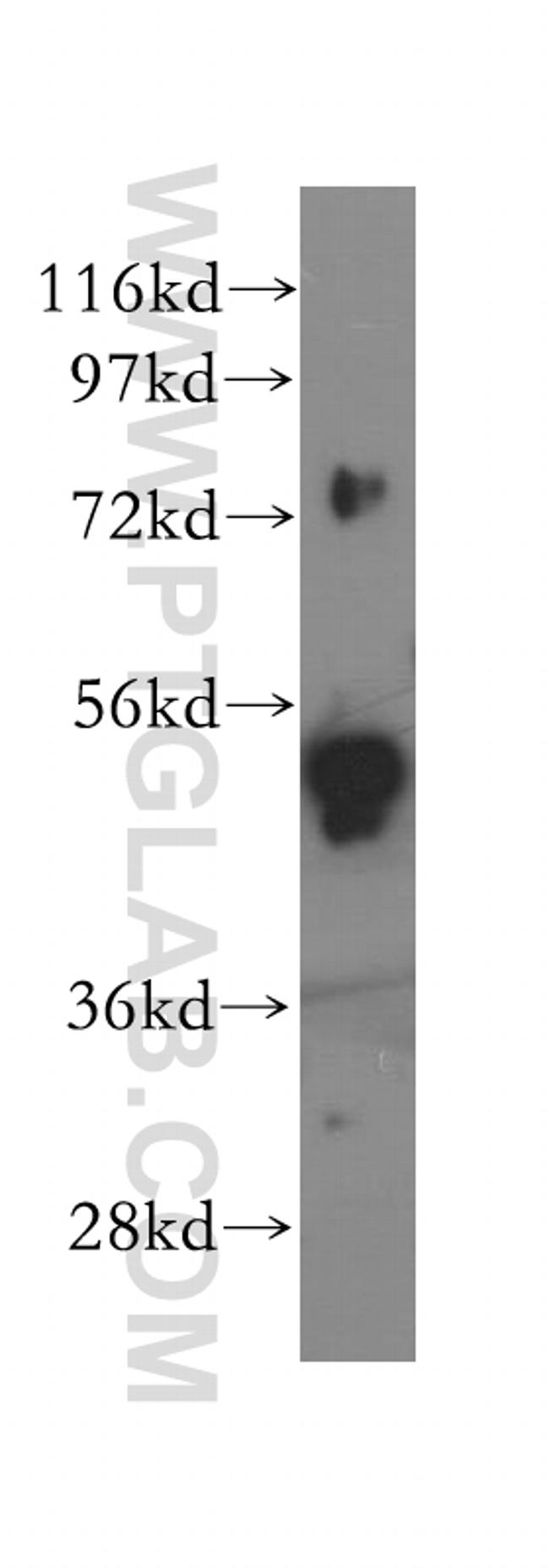 SNX4 Antibody in Western Blot (WB)