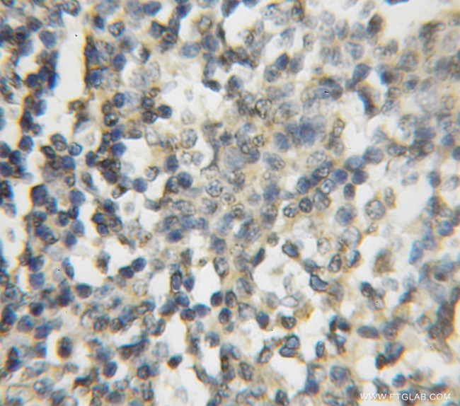 FNTB Antibody in Immunohistochemistry (Paraffin) (IHC (P))