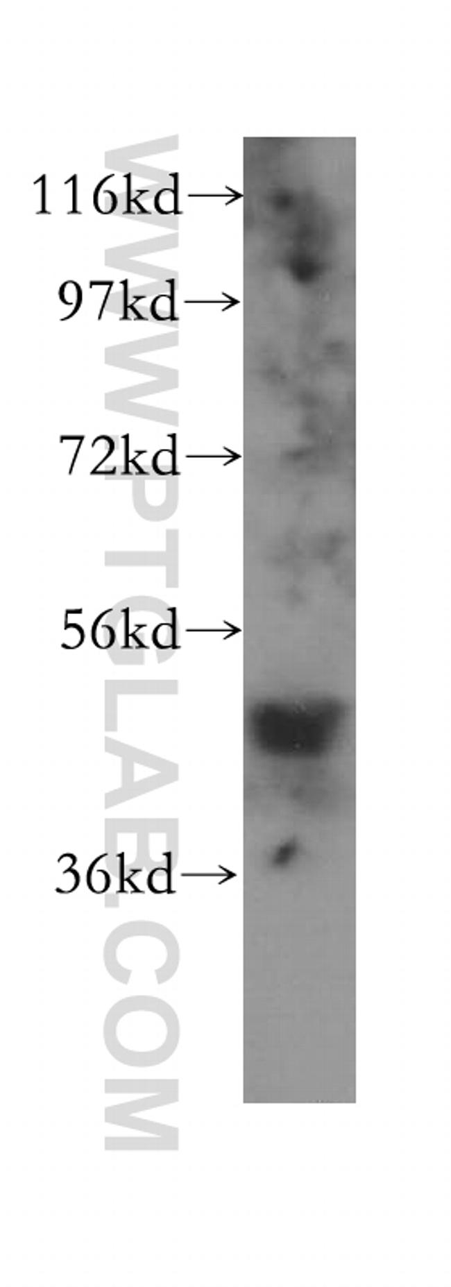 FNTB Antibody in Western Blot (WB)