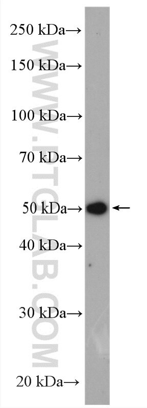 FNTB Antibody in Western Blot (WB)