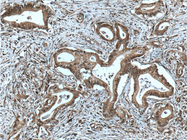 PTP4A1/PRL1 Antibody in Immunohistochemistry (Paraffin) (IHC (P))