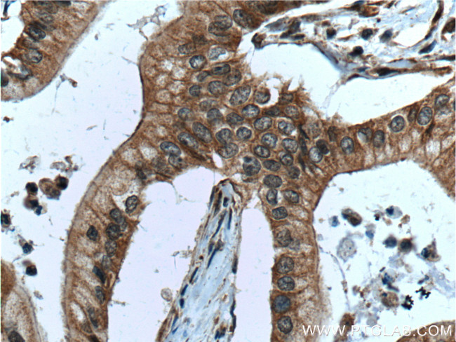 PTP4A1/PRL1 Antibody in Immunohistochemistry (Paraffin) (IHC (P))