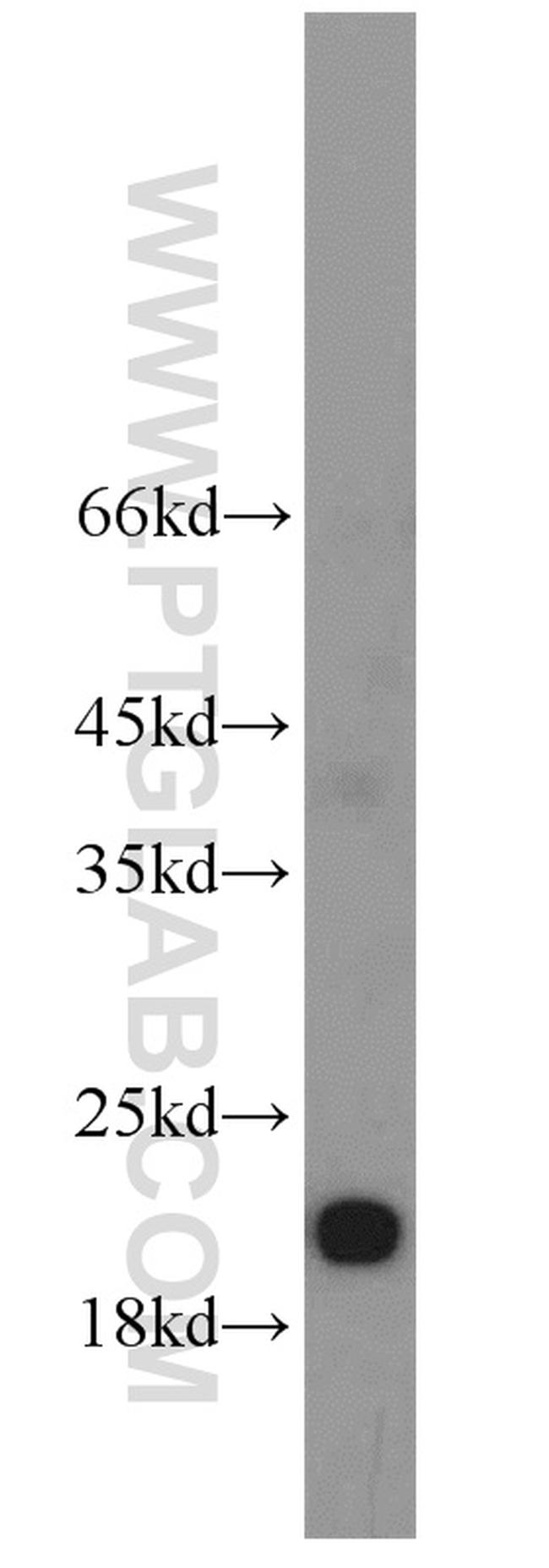 PTP4A1/PRL1 Antibody in Western Blot (WB)