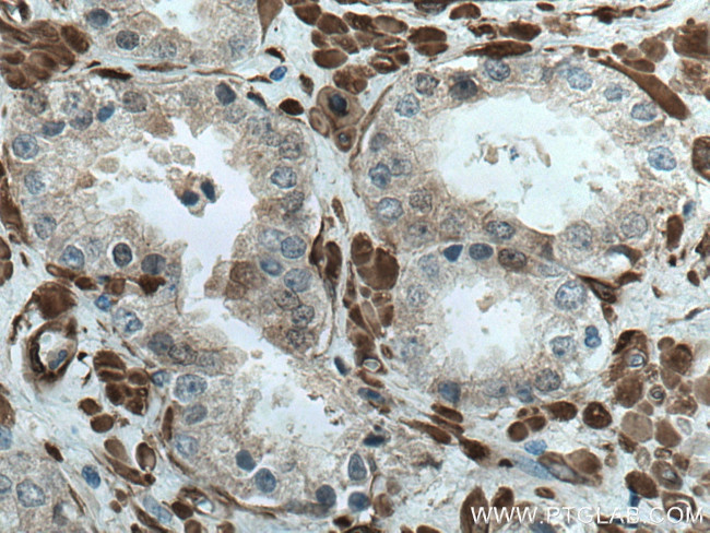 CNN3 Antibody in Immunohistochemistry (Paraffin) (IHC (P))