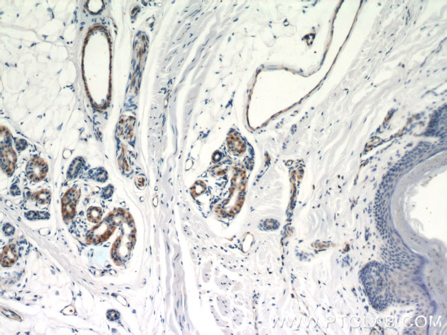 CNN3 Antibody in Immunohistochemistry (Paraffin) (IHC (P))