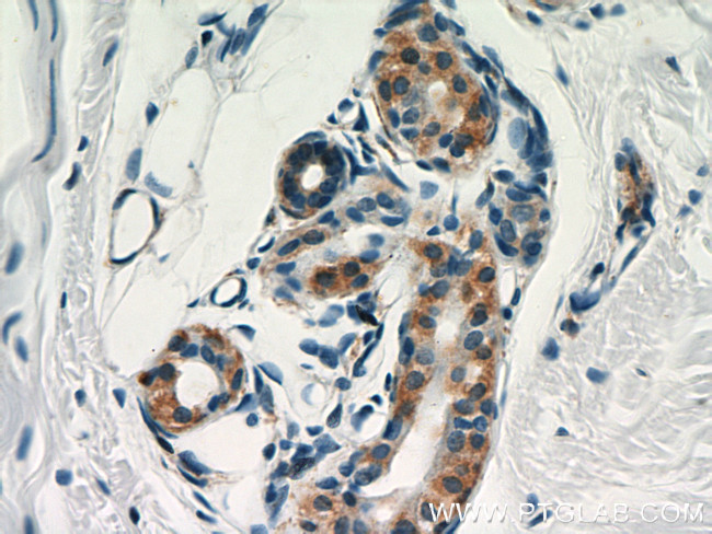 CNN3 Antibody in Immunohistochemistry (Paraffin) (IHC (P))